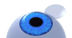 Read more about the article A Complete Guide on Importance of Corneal Thickness to LASIK